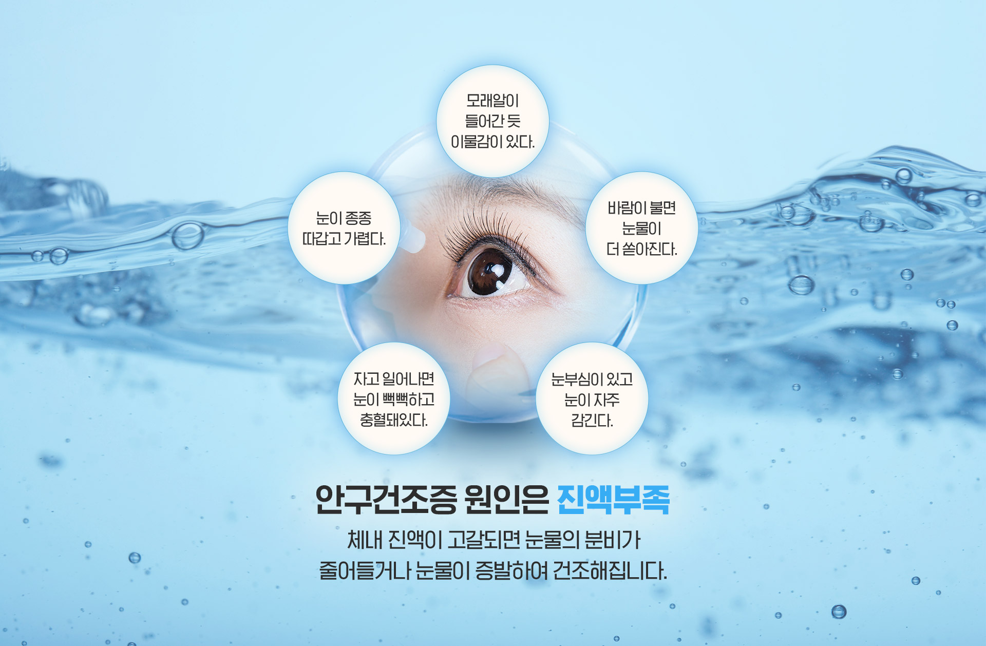 안구건조증원인은 진액부족