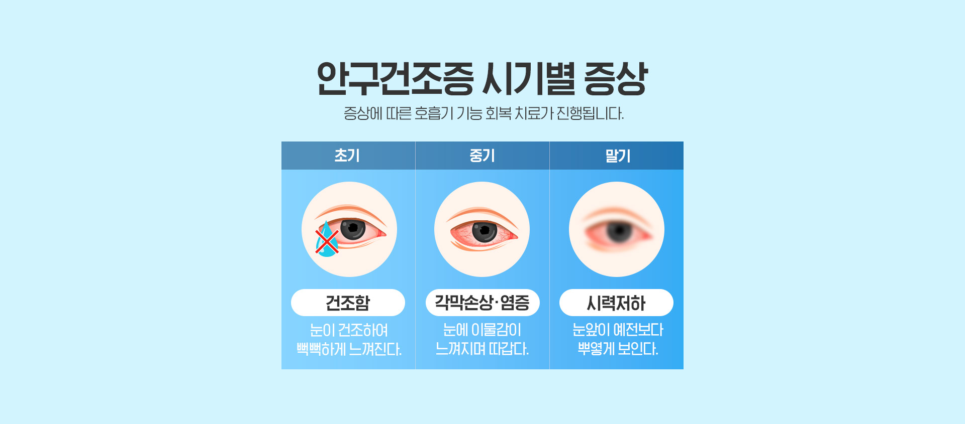 안구건조증 시기별 증상